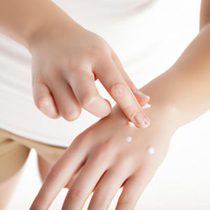Cách Chữa đốm Nâu Trên Da Tay